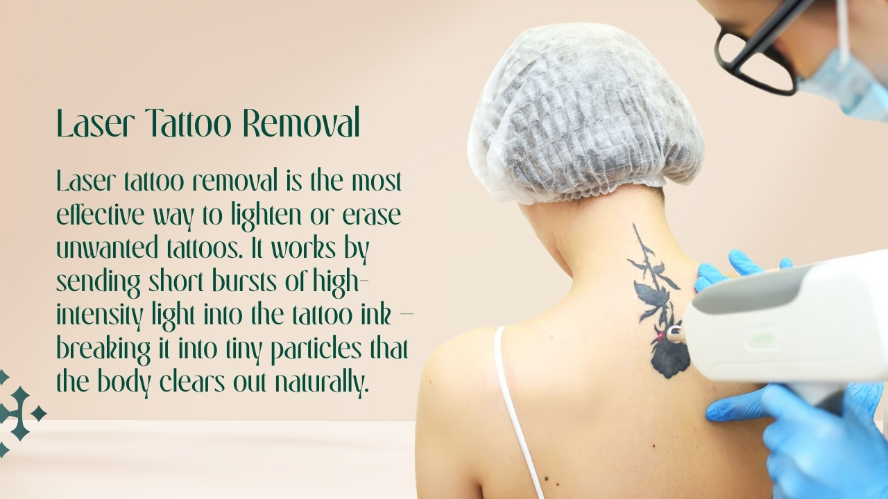 tatto-removal-1779707406.jpg