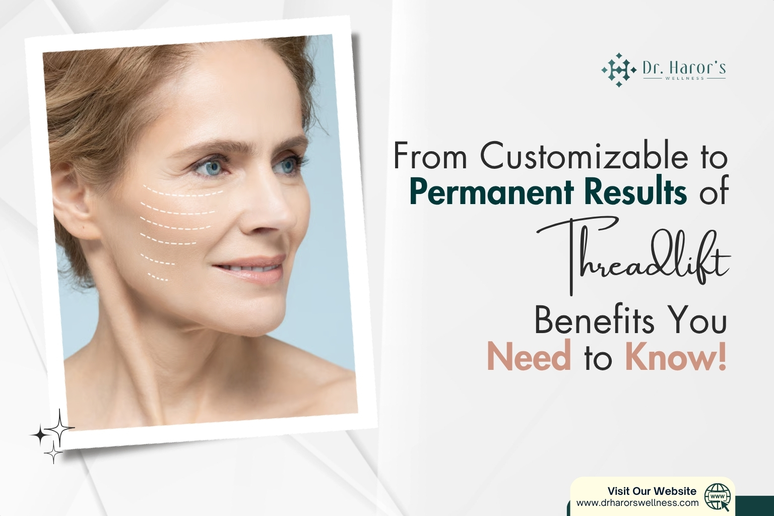 threadlift-1-1781088255.jpg