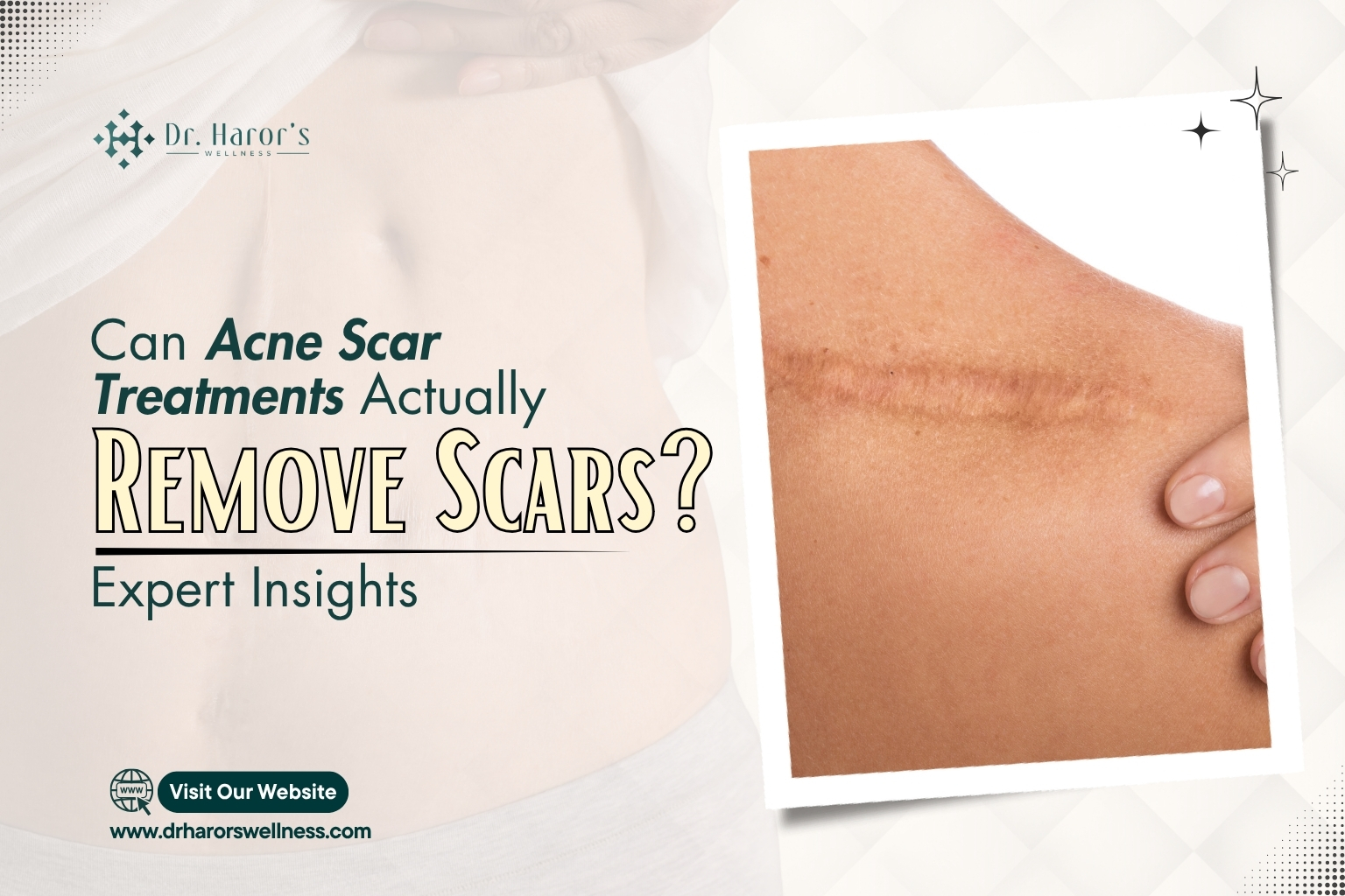 scars-1jpg-1781250207.jpeg