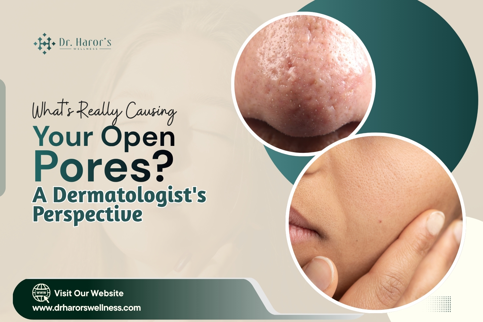 open-pores-1-1782986766.jpg