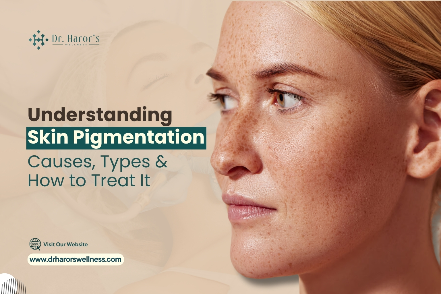 skin-pigmentation-1-1786441241.jpg