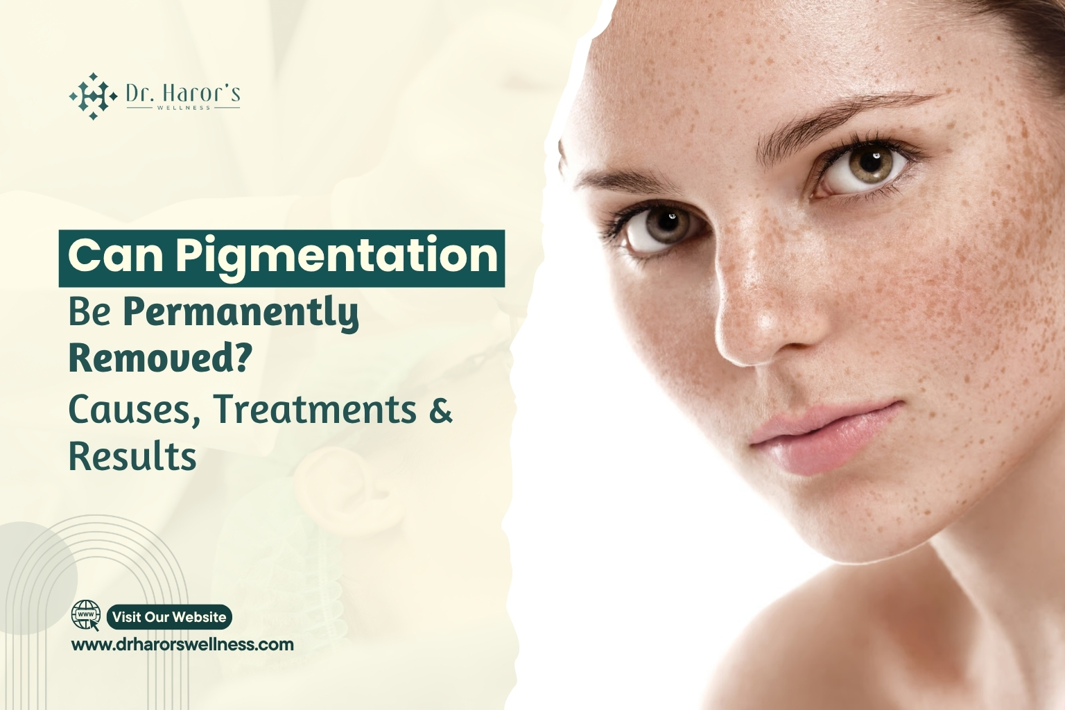 pigmentation-1786539352.jpg