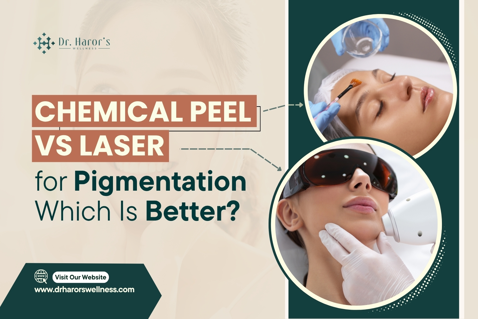 chemical-peel-vs-laser-1-1786618041.jpg