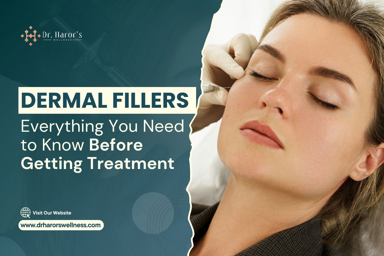 dermal-fillers-1-1787051212.jpg