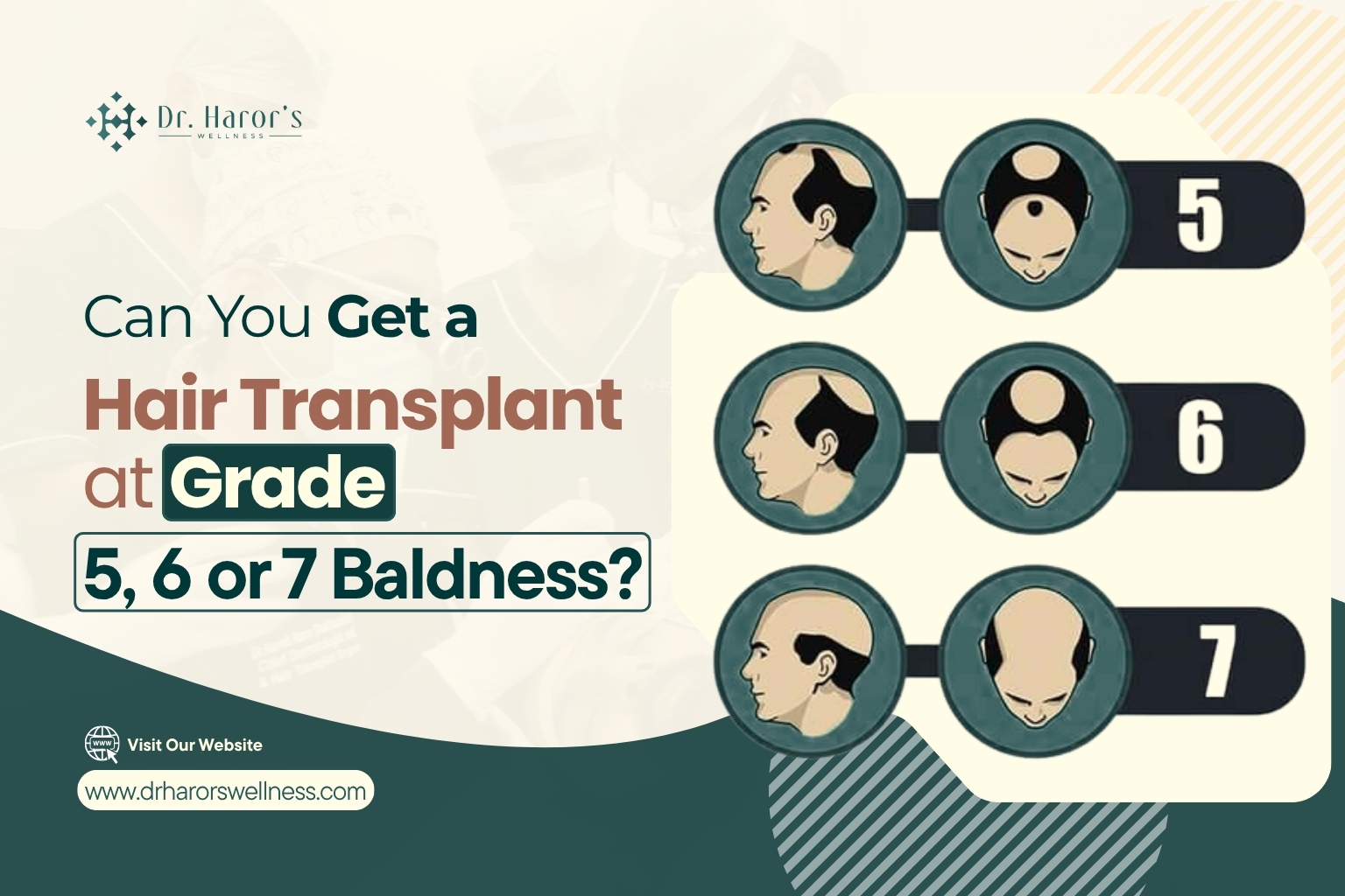 567-baldness-1787391784.jpg